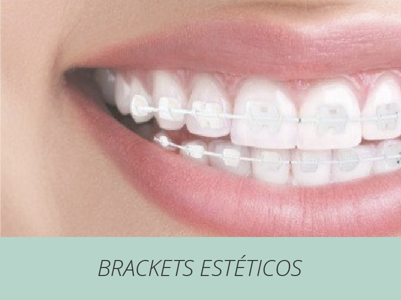 brackets estéticos