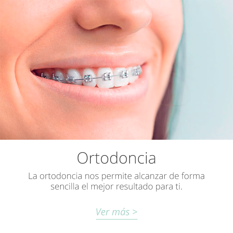 tratamientos de ortodoncia