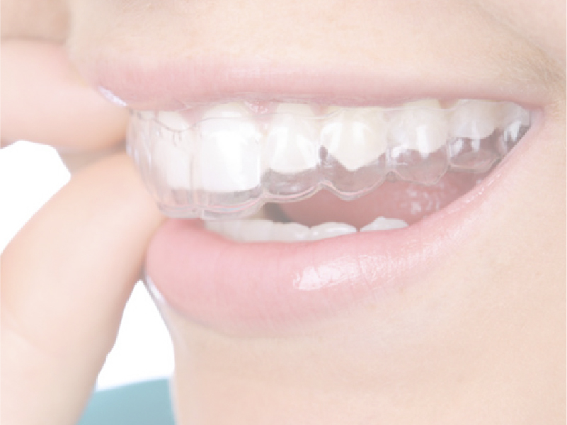 Consejos para mantener tu ortodoncia perfecta