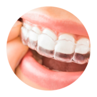 invisalign gijon