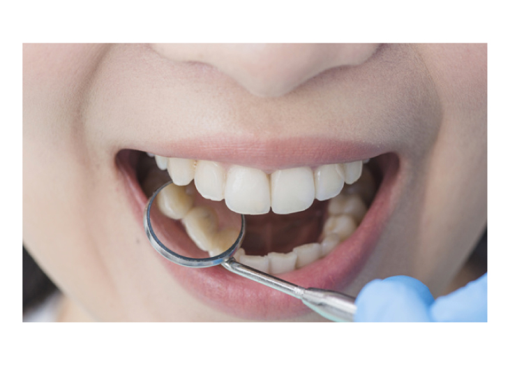 ¿Qué son las enfermedades periodontales o de encías?