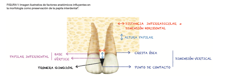 papila interdental