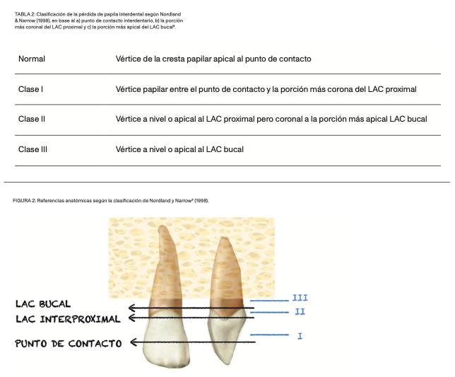 papila interdental