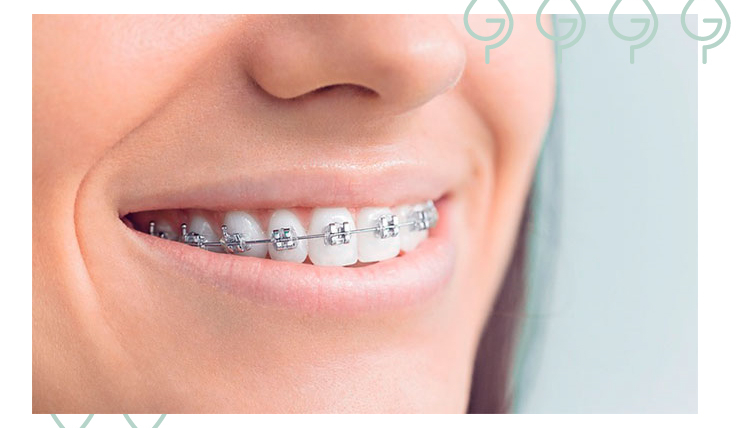 ¿Cómo se hace un buen estudio de ortodoncia?