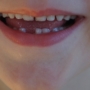 Consejos para la salud dental de los peques