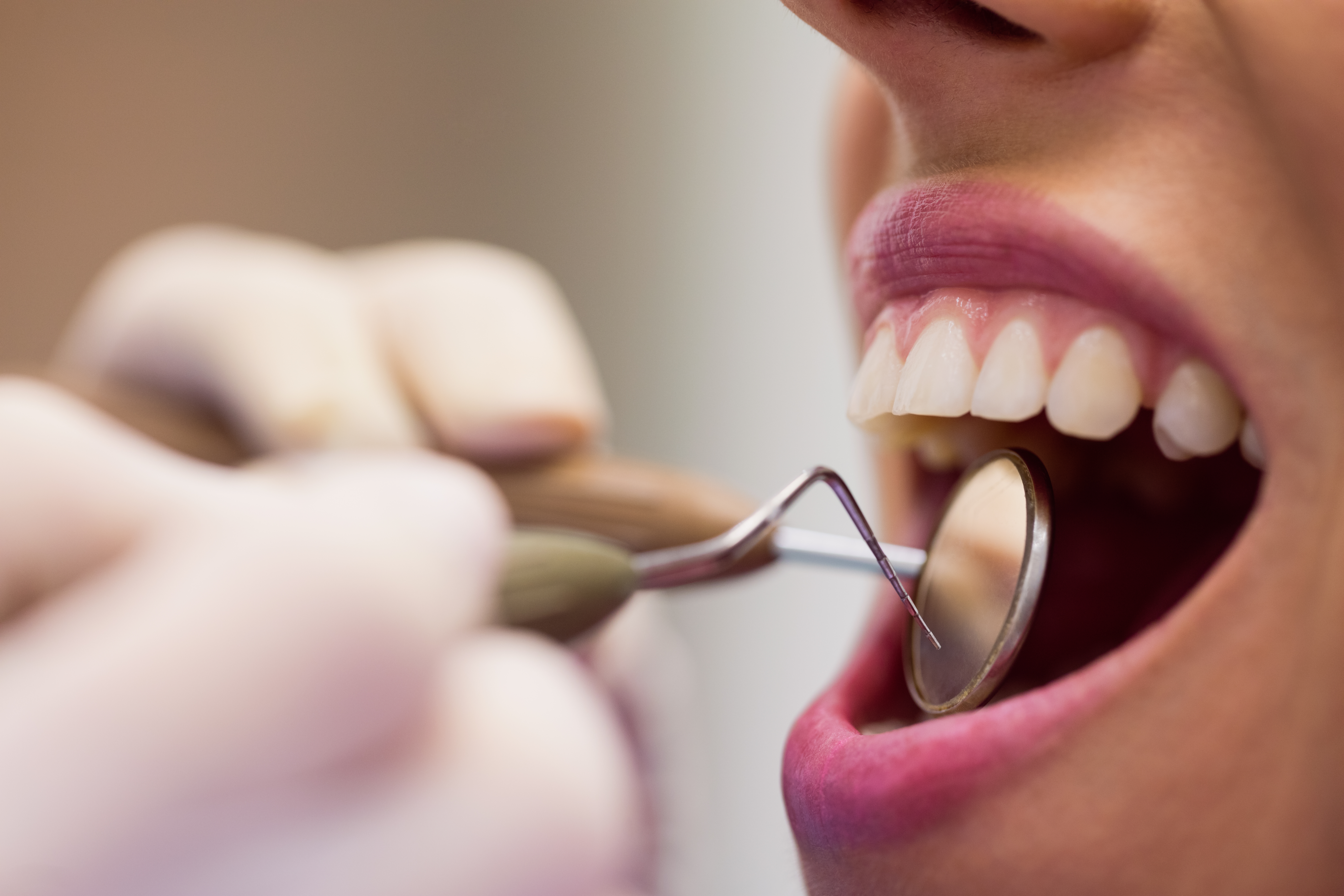 Alternativas a las amalgamas dentales