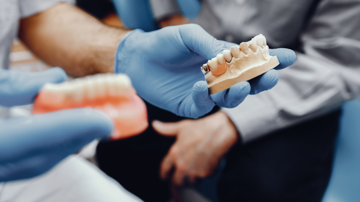 Prótesis dentales fijas: todo lo que debes saber